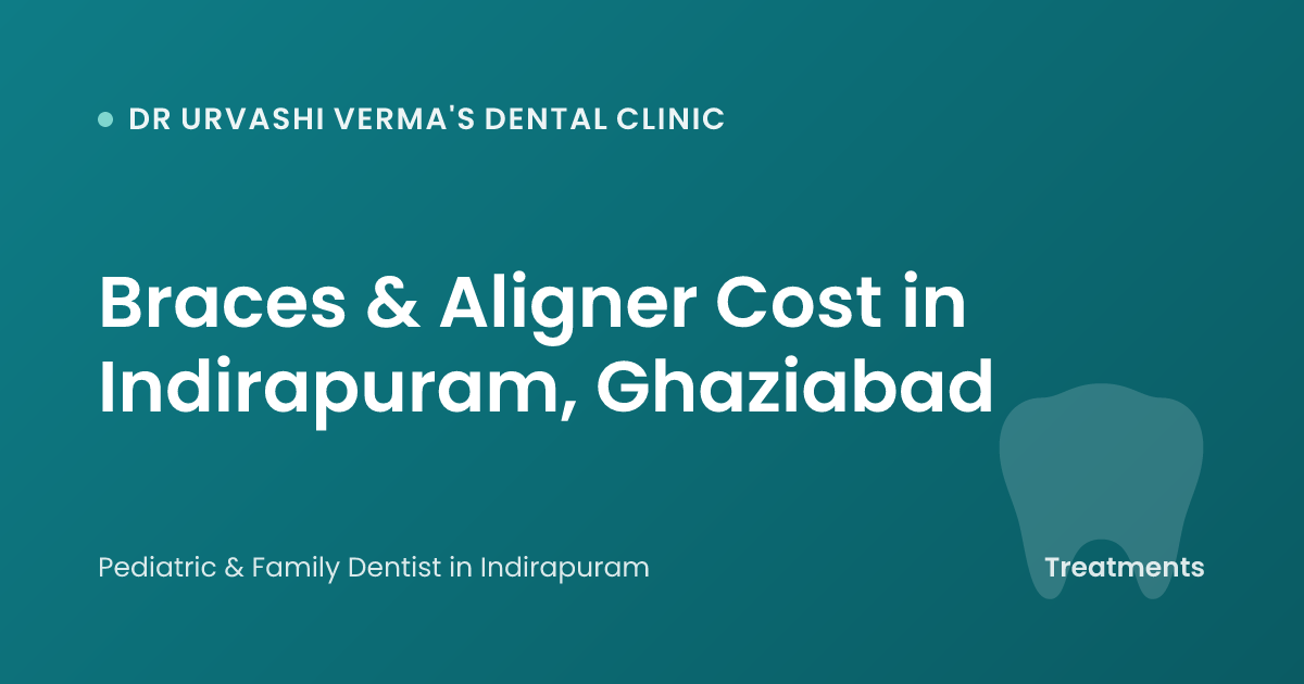 Braces & Aligner Cost in Indirapuram, Ghaziabad