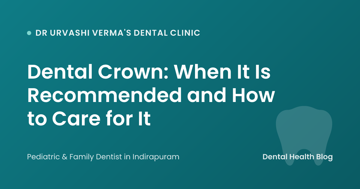 Dental Crown: When It Is Recommended and How to Care for It
