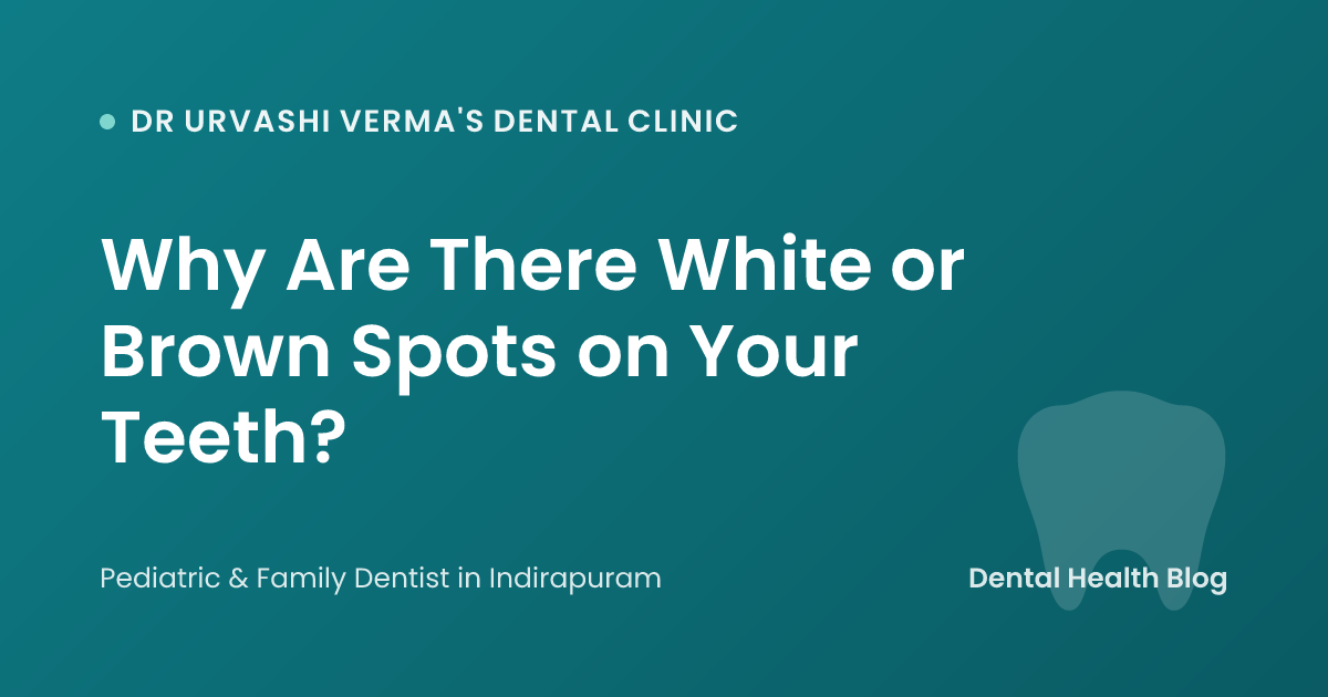 Why Are There White or Brown Spots on Your Teeth?