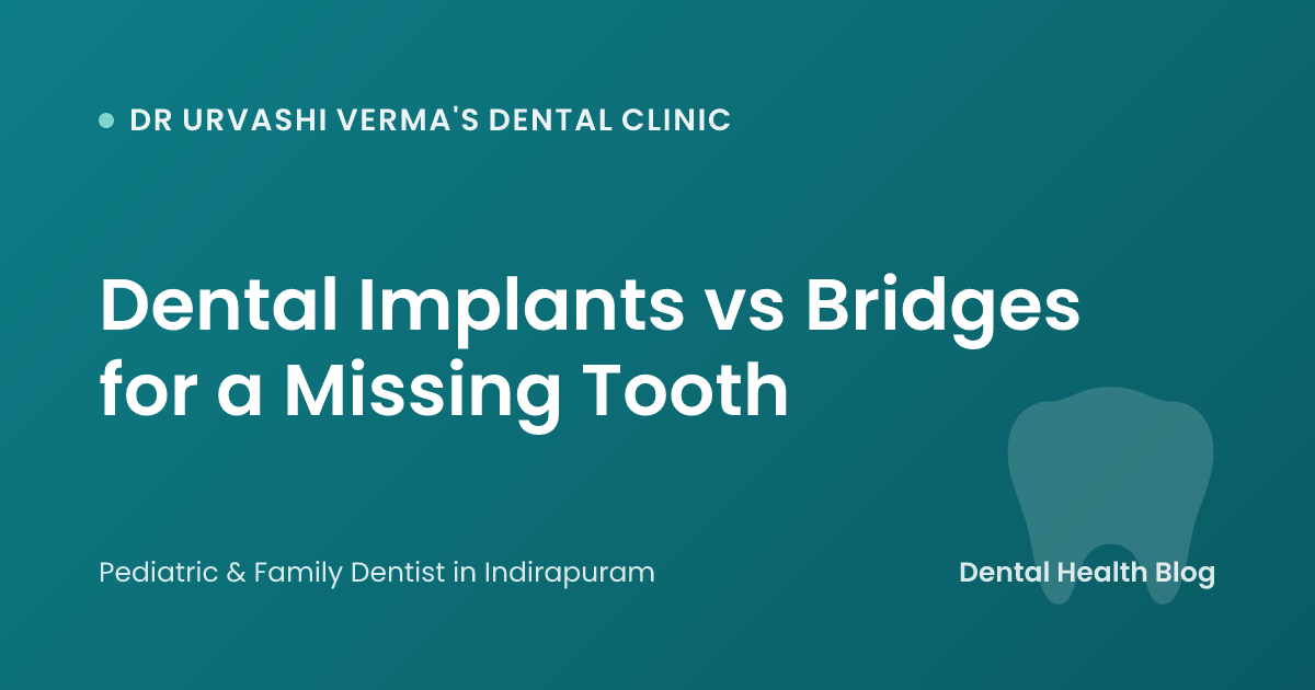 Dental Implants vs Bridges for a Missing Tooth