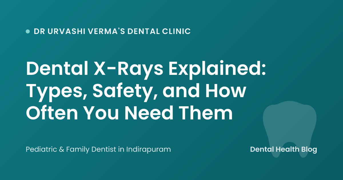 Dental X-Rays Explained: Types, Safety, and How Often You Need Them