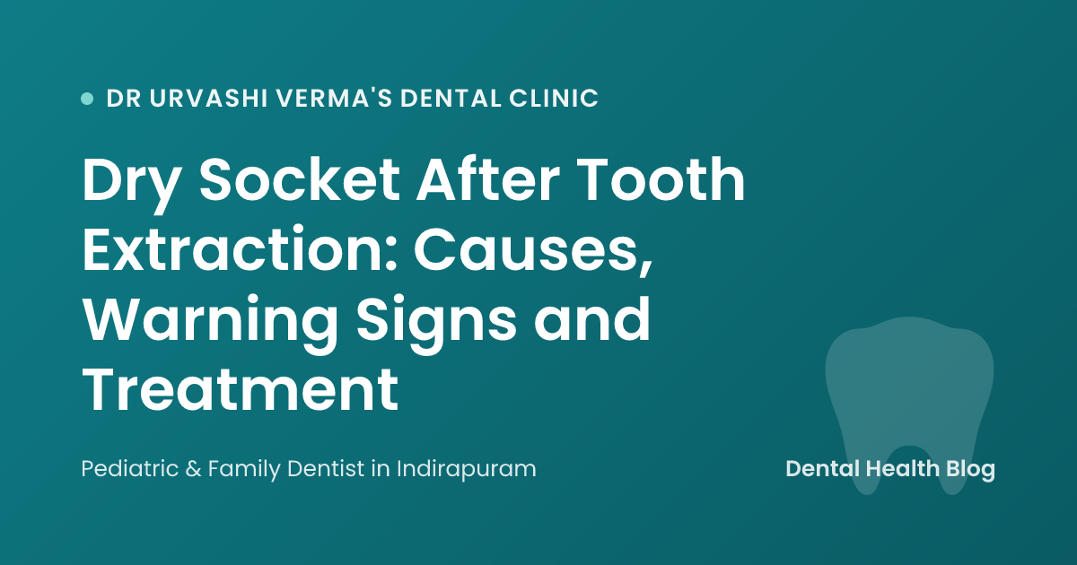 Dry Socket After Tooth Extraction: Causes, Warning Signs and Treatment