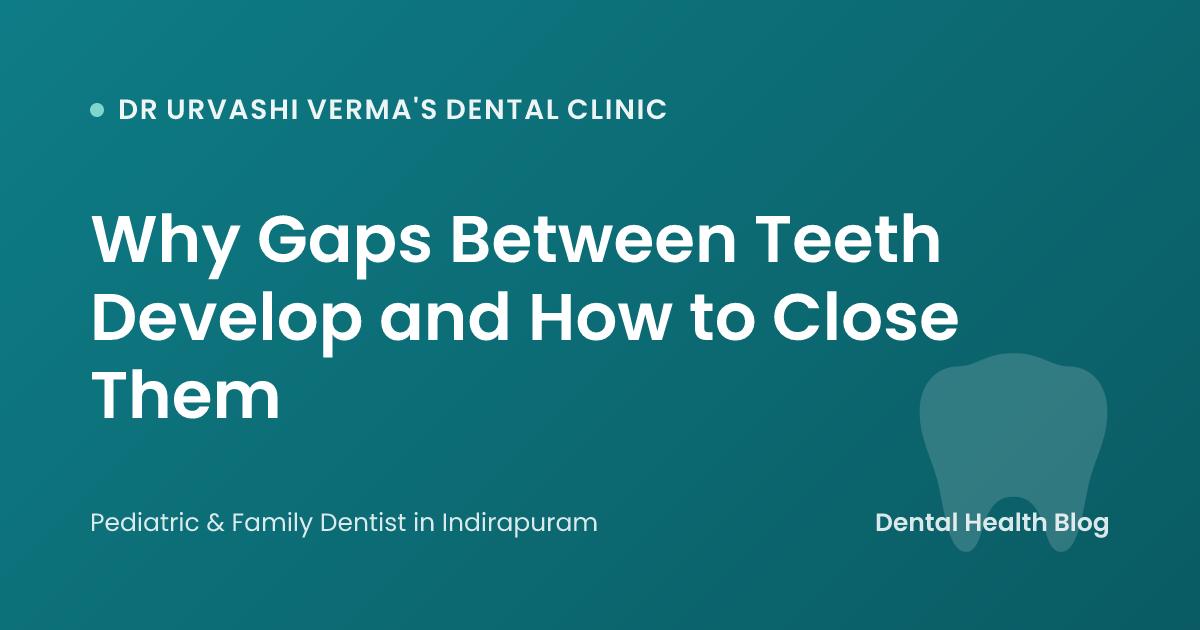 Why Gaps Between Teeth Develop and How to Close Them