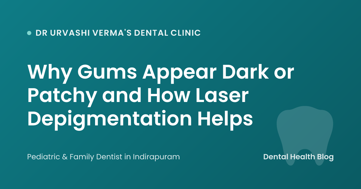 Why Gums Appear Dark or Patchy and How Laser Depigmentation Helps