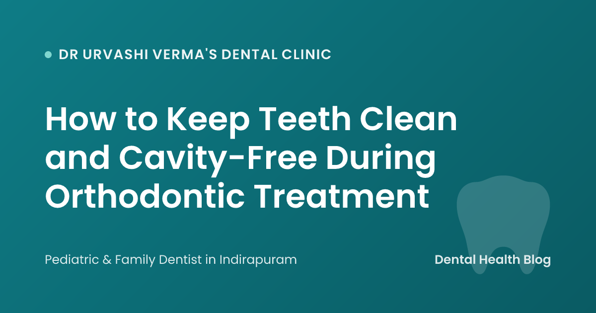 How to Keep Teeth Clean and Cavity-Free During Orthodontic Treatment
