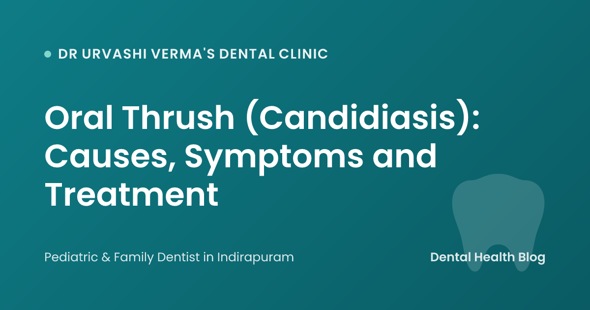 Oral Thrush (Candidiasis): Causes, Symptoms and Treatment