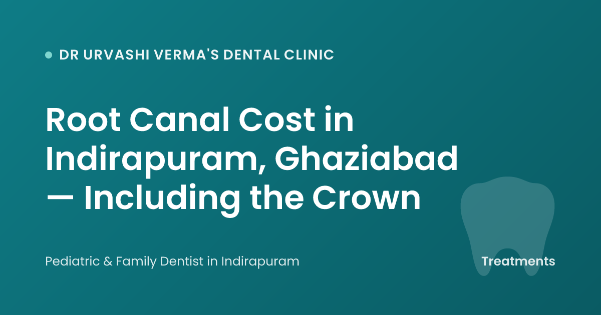 Root Canal Cost in Indirapuram, Ghaziabad — Including the Crown