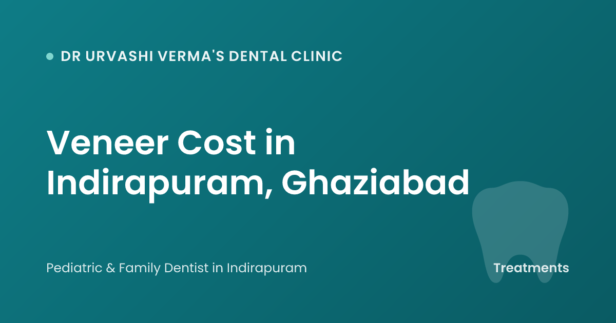 Veneer Cost in Indirapuram, Ghaziabad