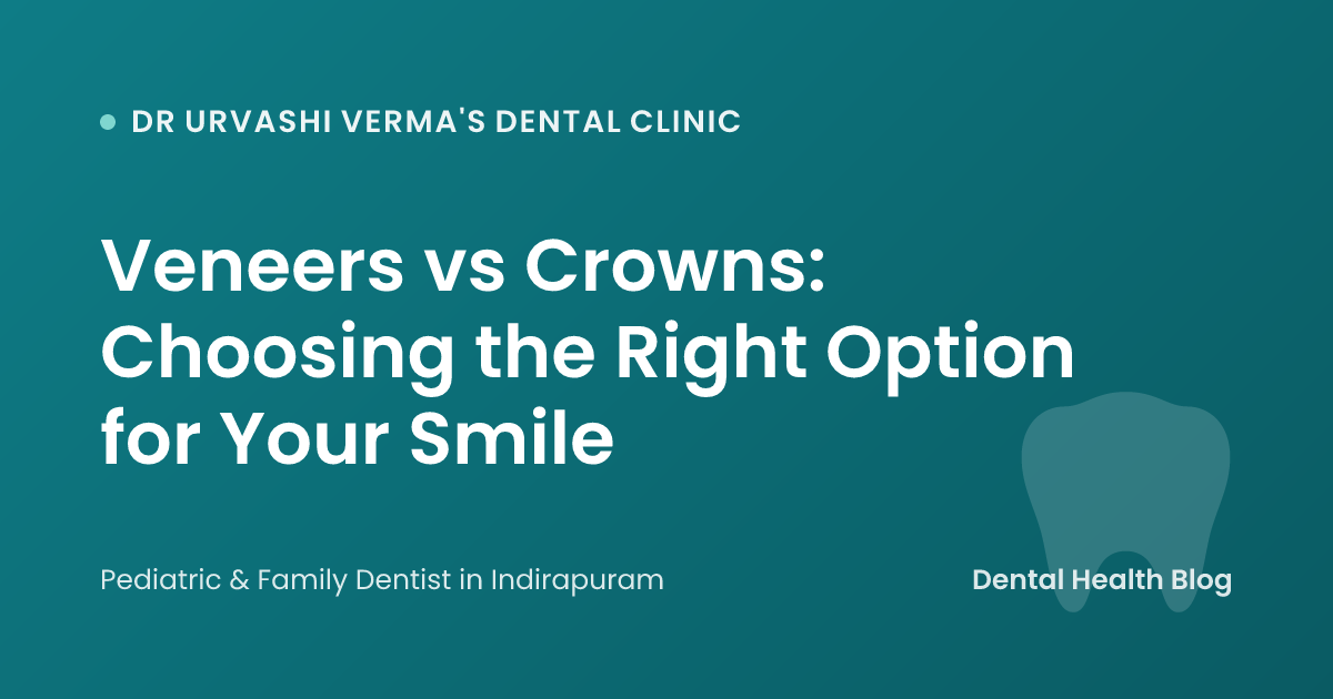 Veneers vs Crowns: Choosing the Right Option for Your Smile