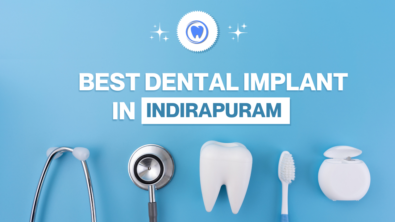 Read more about the article Dental Implant in Indirapuram – Dr. Urvashi Verma